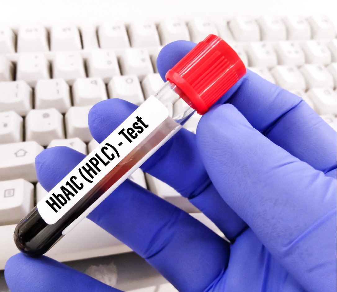 PML Basic + HbA1C-100